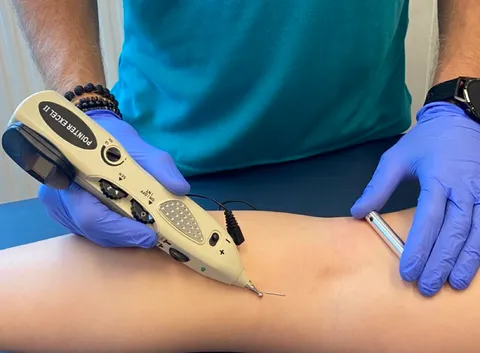 POINTER EXCEL II electroacupuncture device in use